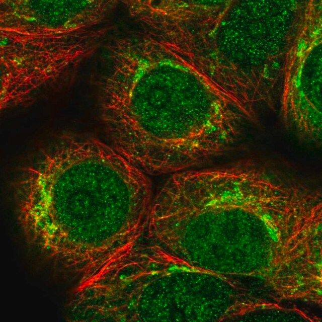 Anti-PKMYT1 antibody produced in rabbit