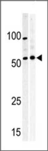 Anti-PKMYT1 (C-term) antibody produced in rabbit