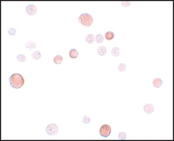 Anti-PLAC1 antibody produced in rabbit