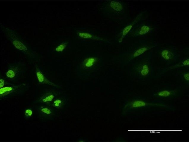 Anti-PKNOX1 antibody produced in mouse