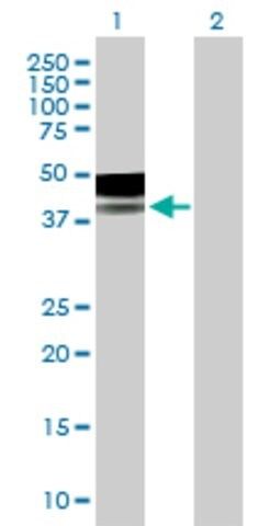 Anti-PLA2G15 antibody produced in mouse