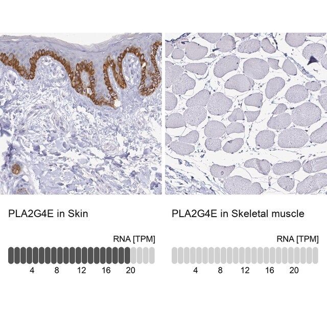 Anti-PLA2G4E antibody produced in rabbit