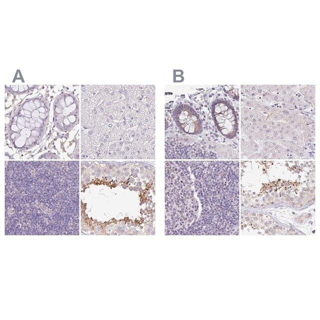 Anti-PLCD4 antibody produced in rabbit