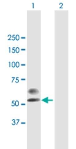 Anti-PLA2G3 antibody produced in mouse