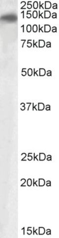 Anti-PLA2R1 antibody produced in goat