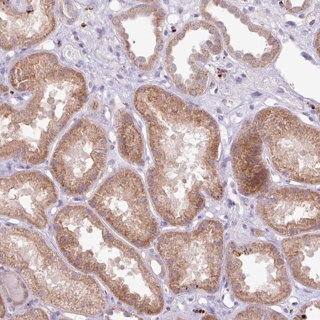 Anti-PLEKHH3 antibody produced in rabbit