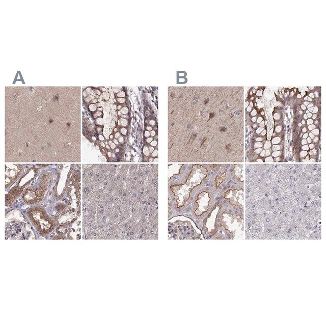 Anti-PLEKHG3 antibody produced in rabbit