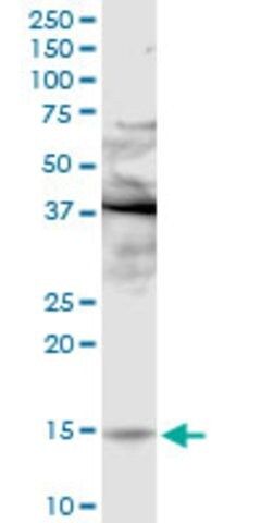 Anti-PLA2G2E antibody produced in rabbit