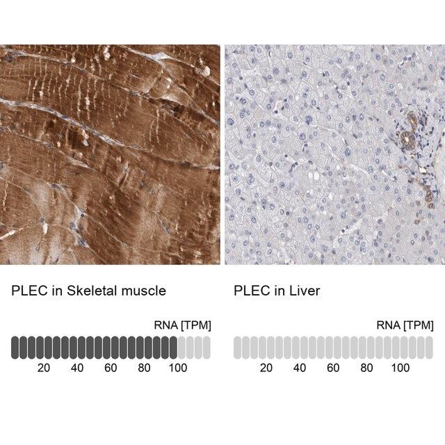 Anti-PLEC antibody produced in rabbit