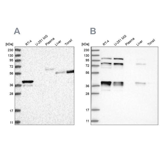 Anti-PLEKHA3 antibody produced in rabbit