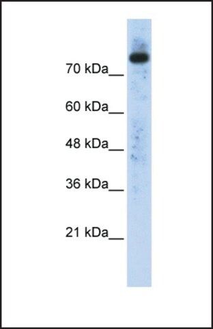 Anti-PLD2