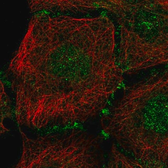 Anti-PLEKHA7 antibody produced in rabbit