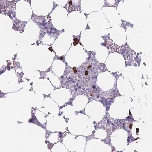 Anti-PLEKHG2 antibody produced in rabbit