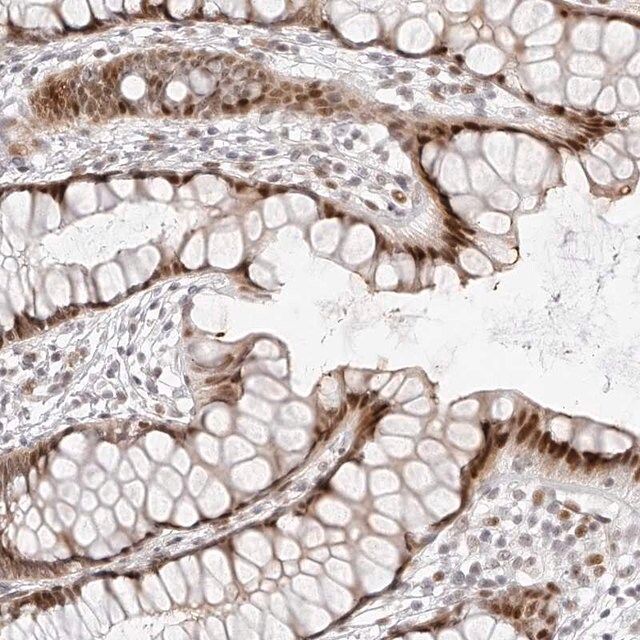 Anti-PLEKHG1 antibody produced in rabbit