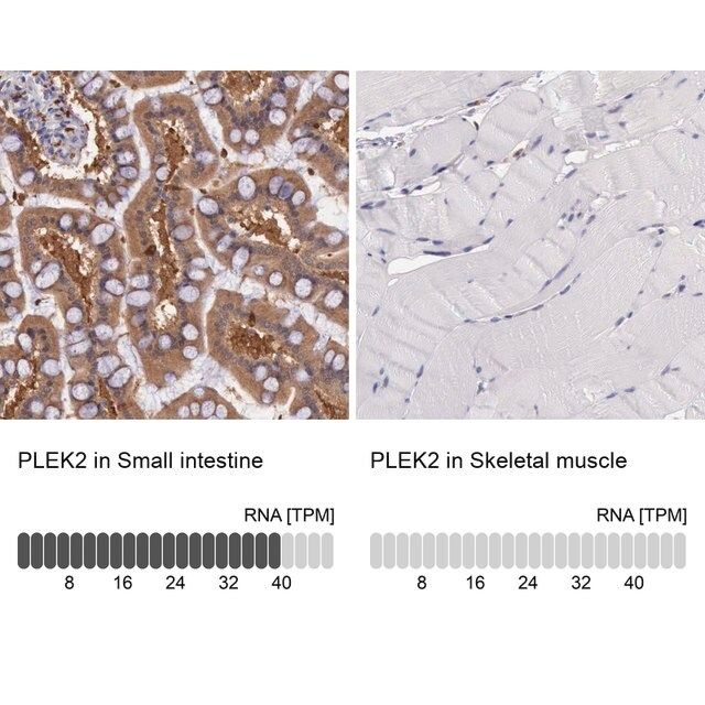 Anti-PLEK2 antibody produced in rabbit