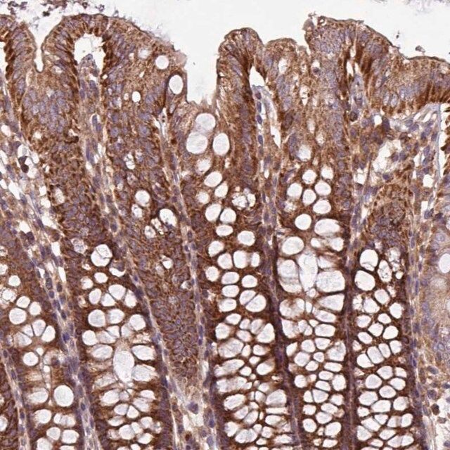 Anti-PLEKHD1 antibody produced in rabbit