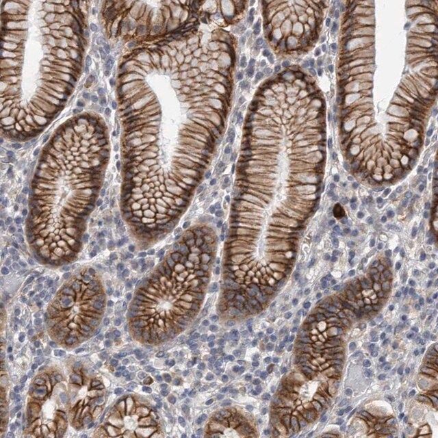 Anti-PLEKHA6 antibody produced in rabbit