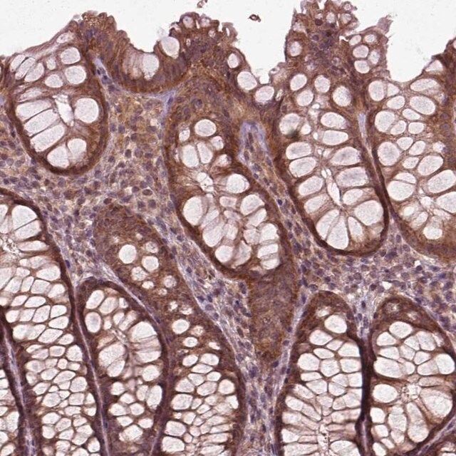 Anti-PLCD3 antibody produced in rabbit