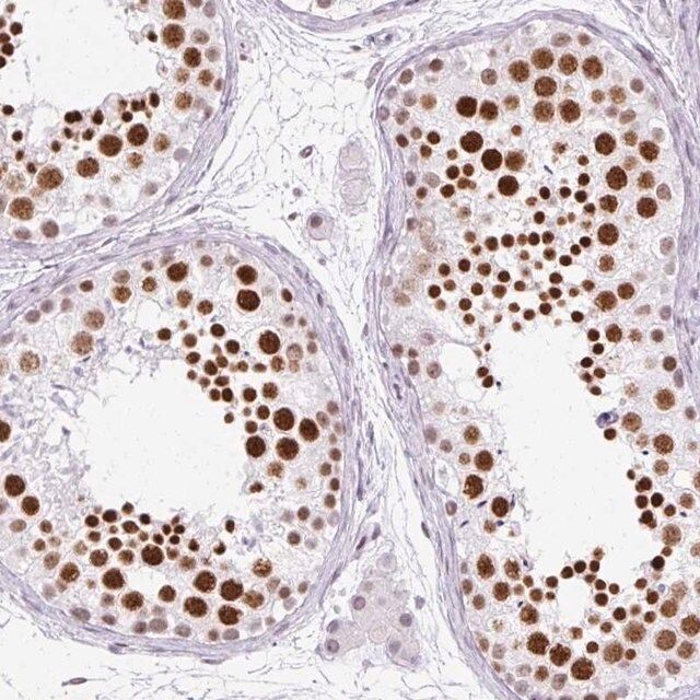 Anti-PLCXD2 antibody produced in rabbit