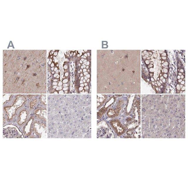 Anti-PLEKHG3 antibody produced in rabbit