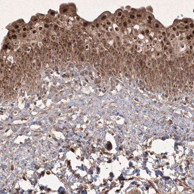 Anti-PLEKHM2 antibody produced in rabbit