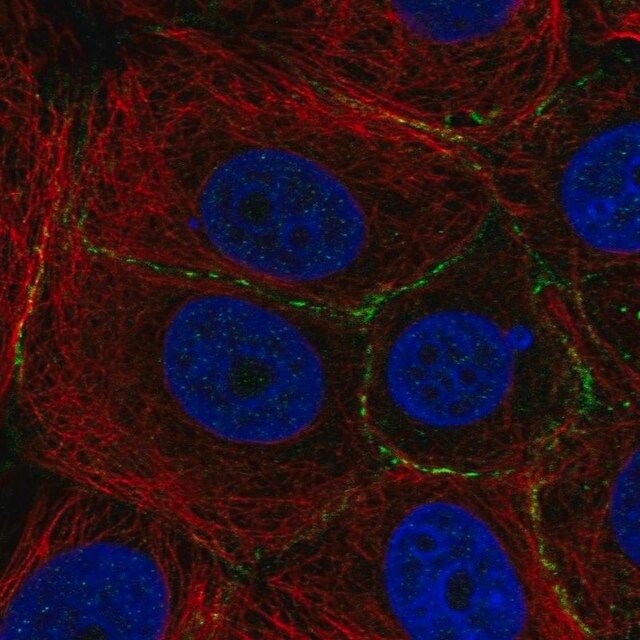 Anti-PLEKHA6 antibody produced in rabbit