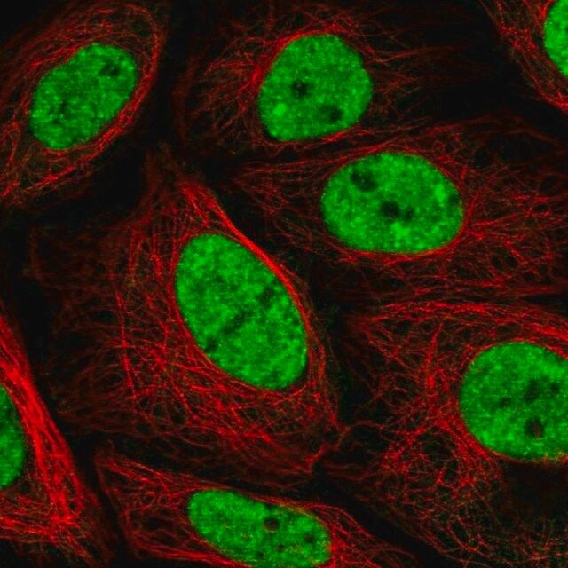 Anti-PLEKHG4B antibody produced in rabbit