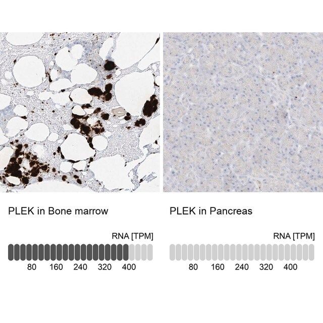 Anti-PLEK antibody produced in rabbit