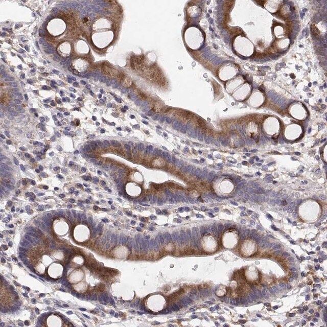 Anti-PLEKHB2 antibody produced in rabbit