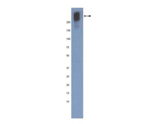 Anti-Plectin Antibody, Clone 10F6