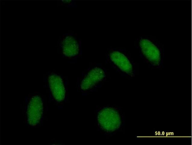 Anti-PLEKHJ1 antibody produced in mouse