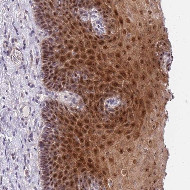 Anti-PLCL2 antibody produced in rabbit