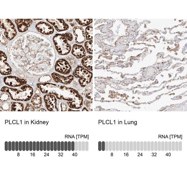 Anti-PLCL1 antibody produced in rabbit