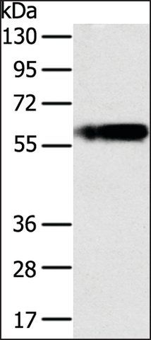 Anti-PLIN1 antibody produced in rabbit