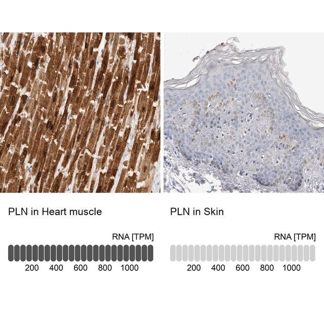 Anti-PLN antibody produced in rabbit