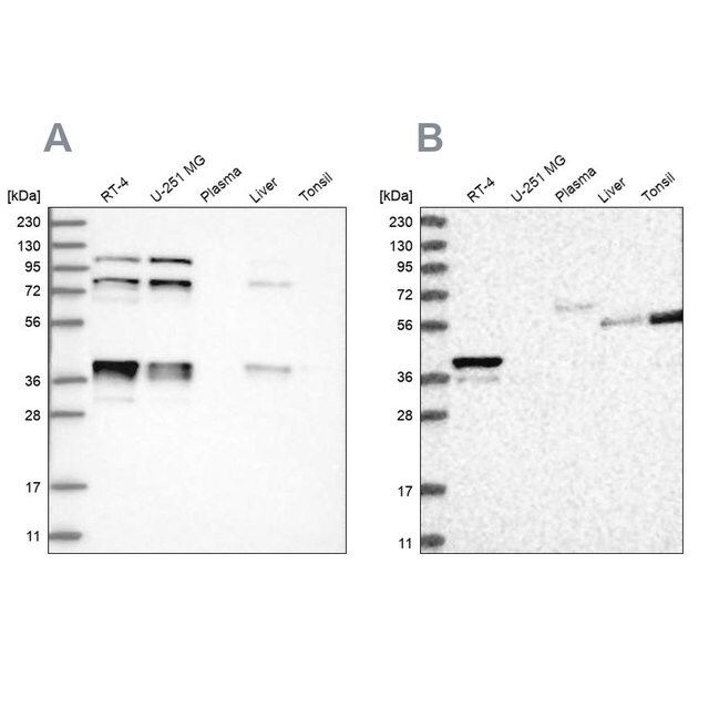 Anti-PLEKHA3 antibody produced in rabbit