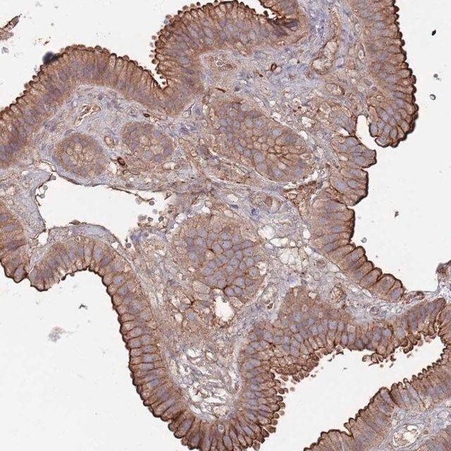 Anti-PLEKHA4 antibody produced in rabbit