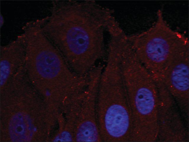 Anti-phospho-SNCA (pTyr<sup>133</sup>) antibody produced in rabbit