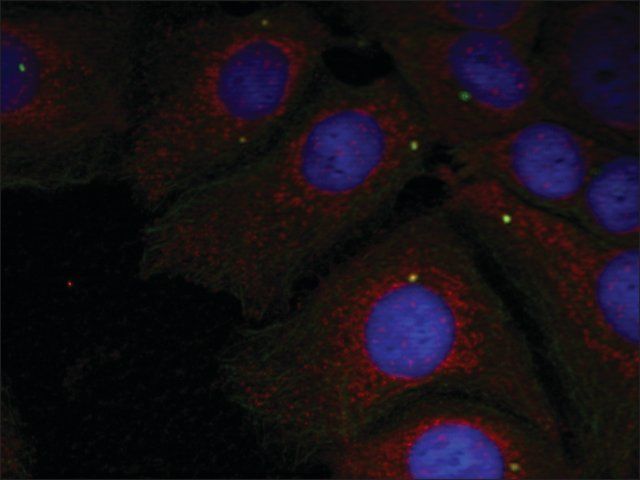 Anti-phospho-SNCA (pTyr<sup>125</sup>) antibody produced in rabbit