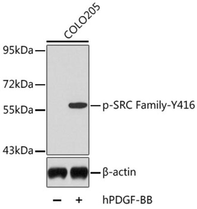 Anti-Phospho-SRC Family-Y416 antibody produced in rabbit