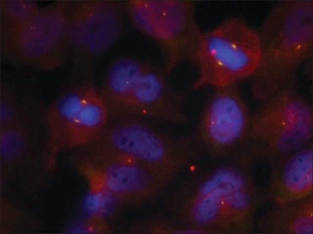 Anti-phospho-SYT2 (pThr<sup>202</sup>) antibody produced in rabbit