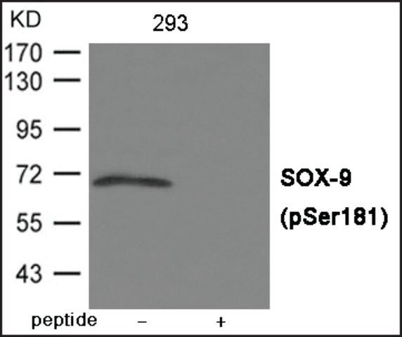 Anti-phospho-SOX-9 (pSer<sup>181</sup>) antibody produced in rabbit