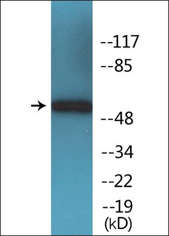 Anti-phospho-SOX-9 (pSer<sup>181</sup>) antibody produced in rabbit