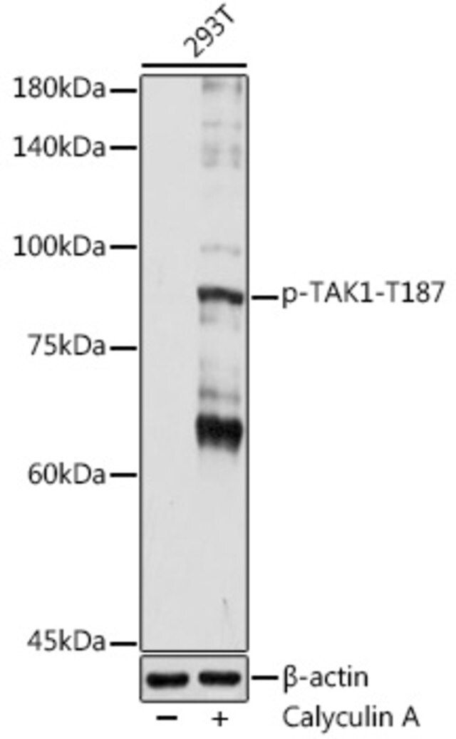 Anti-Phospho-TAK1-T187 antibody produced in rabbit