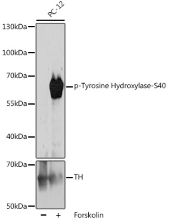 Anti-Phospho-Tyrosine Hydroxylase-S40 antibody produced in rabbit