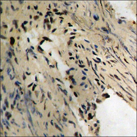 Anti-phospho-Tau (pThr<sup>231</sup>) antibody produced in rabbit