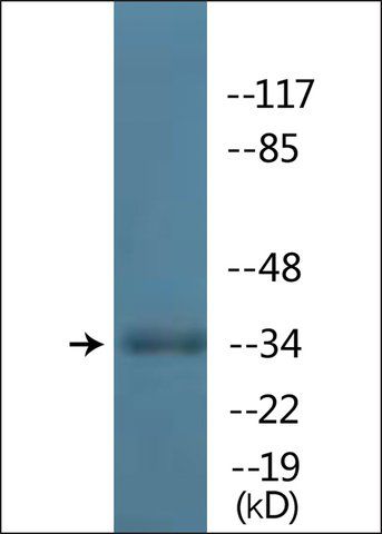 Anti-phospho-TAL-1 (pSer<sup>122</sup>) antibody produced in rabbit