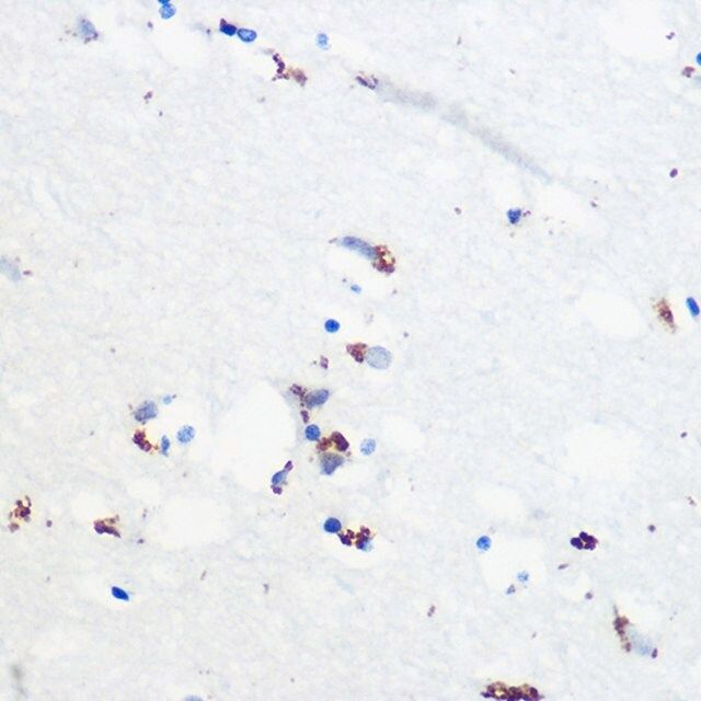 Anti-Phospho-Tau-Ser416 antibody produced in rabbit