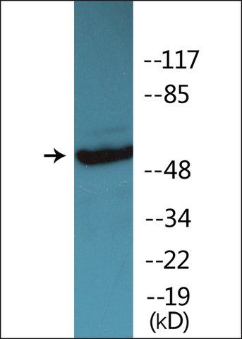 Anti-phospho-Vimentin (pSer<sup>83</sup>) antibody produced in rabbit