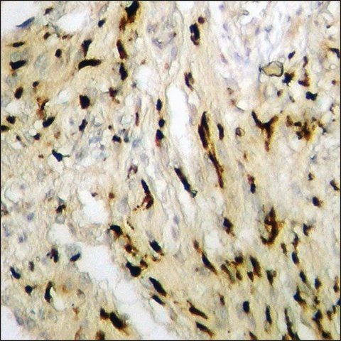 Anti-phospho-GATA4 (pSer<sup>262</sup>) antibody produced in rabbit